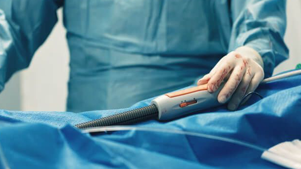 Utilidad de la FFR después de una angioplastia coronaria